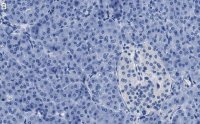 Anti-O-GlcNAc Transferase Antibody, clone 1O19 ZooMAb� Rabbit Monoclonal 