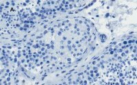 Anti-OCT4 Antibody, clone 4N8, ZooMAb® Rabbit Monoclonal