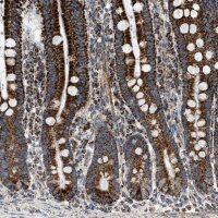 Anti-OGDH antibody produced in rabbit