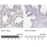 Anti-OIP5 antibody produced in rabbit HPA059602-100UL