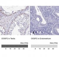 Anti-OOSP2 antibody produced in rabbit 