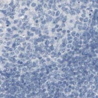 Anti-OPN1SW antibody produced in rabbit