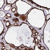 Anti-OSBPL5 antibody produced in rabbit 