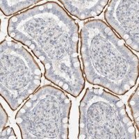Anti-OSBPL7 antibody produced in rabbit 