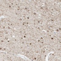 Anti-OSBPL7 antibody produced in rabbit 