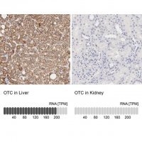 Anti-OTC antibody produced in rabbit