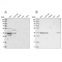 Anti-OTUD6B antibody produced in rabbit HPA024046-100UL
