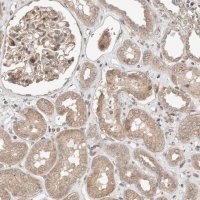 Anti-OTUD6B antibody produced in rabbit HPA024046-100UL