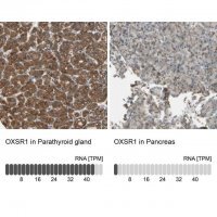 Anti-OXSR1 antibody produced in rabbit HPA008237-100UL