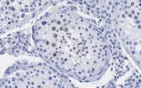 Anti-p14ARF Antibody, clone 4F19 ZooMAb� Rabbit Monoclonal 