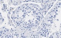 Anti-p14ARF Antibody, clone 4F19 ZooMAb� Rabbit Monoclonal 
