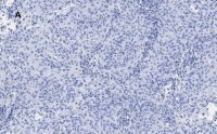 Anti-p21 Antibody, clone 5G7, ZooMAb� Rabbit Monoclonal 
