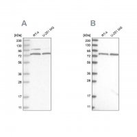 Anti-P2RX7 antibody produced in rabbit 