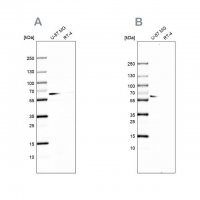 Anti-P4HA2 antibody produced in rabbit