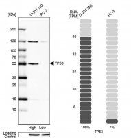 Anti-p53 antibody produced in rabbit 