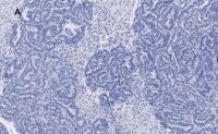 Anti-p53 Antibody, clone 6O23, ZooMAb� Rabbit Monoclonal 