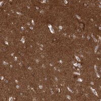 Anti-PACS1 antibody produced in rabbit
