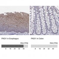 Anti-PADI1 antibody produced in rabbit 
