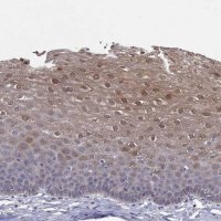 Anti-PADI1 antibody produced in rabbit 