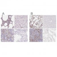 Anti-PADI4 antibody produced in rabbit 