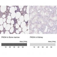Anti-PADI4 antibody produced in rabbit 