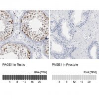Anti-PAGE1 antibody produced in rabbit