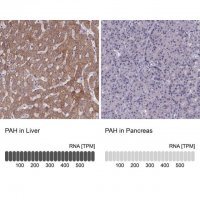 Anti-PAH antibody produced in rabbit HPA031642-100UL