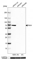 Anti-PAK4 antibody produced in rabbit 