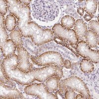 Anti-PALM3 antibody produced in rabbit