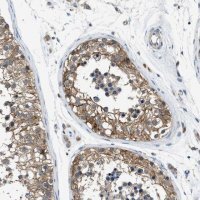 Anti-PANX1 antibody produced in rabbit