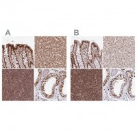 Anti-PAPD7 antibody produced in rabbit 
