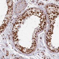 Anti-PAPD7 antibody produced in rabbit 