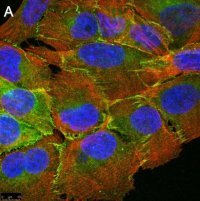 Anti-PARD-3 Antibody, clone 1N18 ZooMAb� Rabbit Monoclonal 