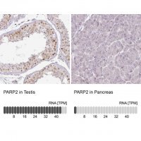 Anti-PARP2 antibody produced in rabbit 