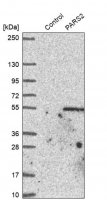 Anti-PARS2 antibody produced in rabbit HPA028314-100UL