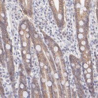 Anti-PBDC1 antibody produced in rabbit HPA003155-100UL