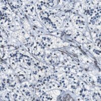 Anti-PBRM1 antibody produced in rabbit 