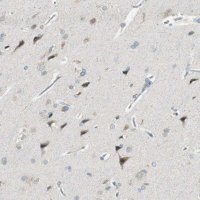 Anti-PCDHB15 antibody produced in rabbit
