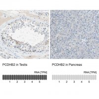 Anti-PCDHB2 antibody produced in rabbit