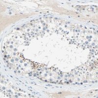 Anti-PCDHB2 antibody produced in rabbit