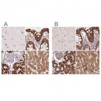 Anti-PCK2 antibody produced in rabbit 