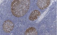 Anti-PCNA Antibody, clone 3B22 ZooMAb® Rabbit Monoclonal