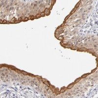 Anti-PCNX4 antibody produced in rabbit HPA002076-100UL