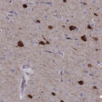 Anti-PCP4L1 antibody produced in rabbit 