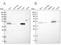 Anti-PCYT2 antibody produced in rabbit