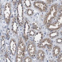 Anti-PDCD6IP antibody produced in rabbit 