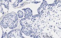 Anti-PDE4B Antibody, clone 1E9 ZooMAb� Rabbit Monoclonal 