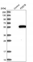 Anti-PDE7B antibody produced in rabbit 