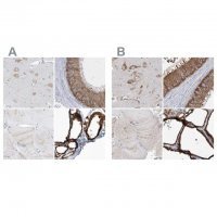 Anti-PDIA6 antibody produced in rabbit