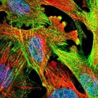 Anti-PDLIM7 antibody produced in rabbit